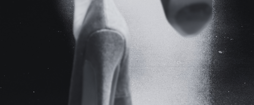 🎬 EPISODIO 5 – Tacchi, Intento e Campo Quantico